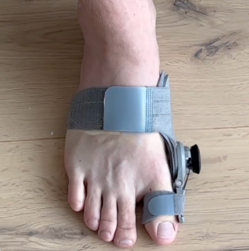 Befestigen Sie ZehBalance+ am großen Zeh und am Fuß.