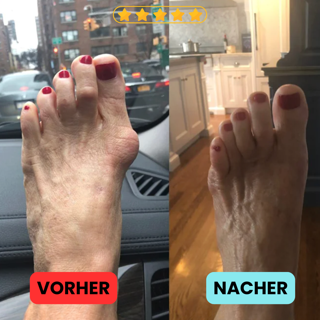 Juvana™ ZehBalance+